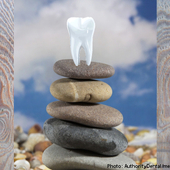 Biologische Zahnmedizin soll den Körper vor Schadstoffbelastungen schützen
